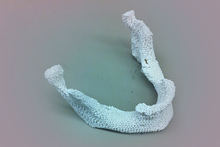 3d-printed-bone-image