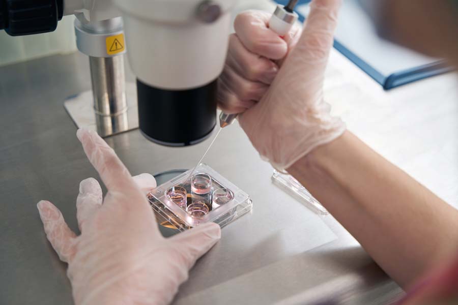 Doctor selects biomaterial with special syringe for subsequent manipulations
