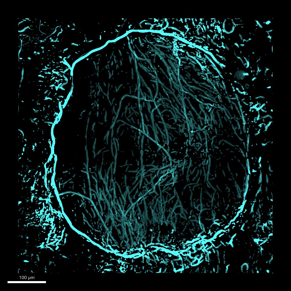 3D nerve maps pinpoint the path to precision bone repair